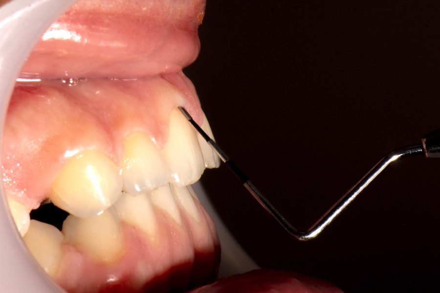 periodonto