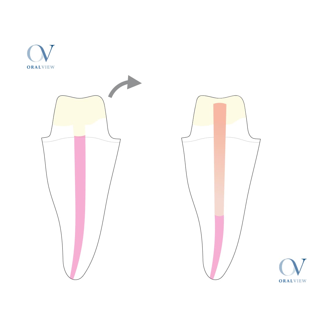 poste dental