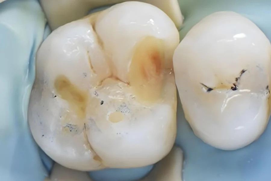 Aislamiento absoluto.