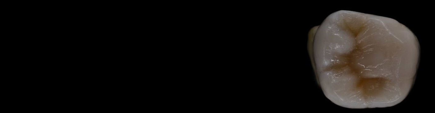 Composite dental